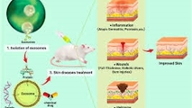 Exosomes as natural vectors for therapeutic delivery of bioactive compounds in skin diseases