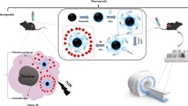 A versatile theranostic magnetic polydopamine iron oxide NIR laser-responsive nanosystem containing doxorubicin for chemo-photothermal therapy of melanoma